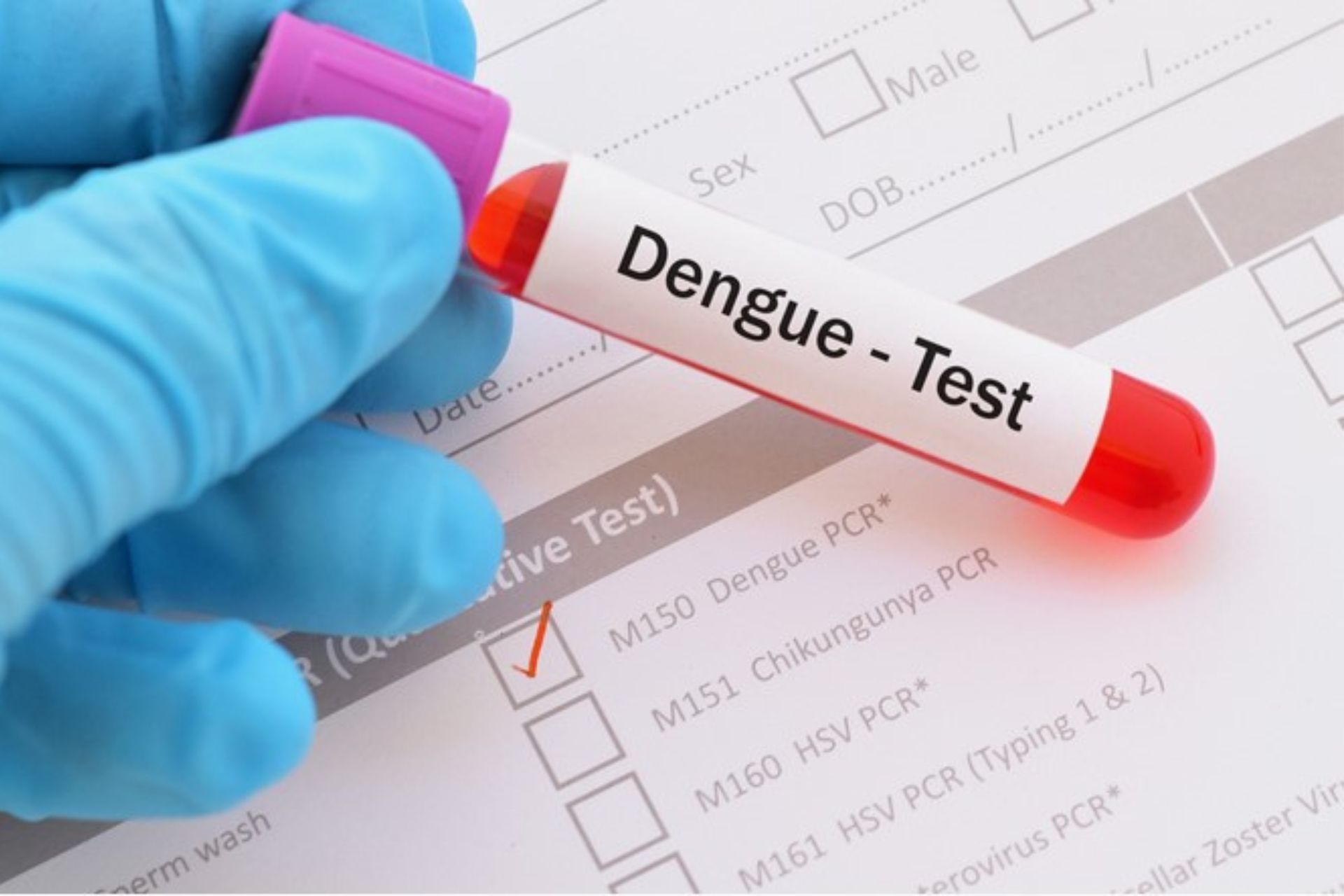 Dengue test price